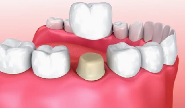  Louisville Kemper DMD Pediatric Dentistry