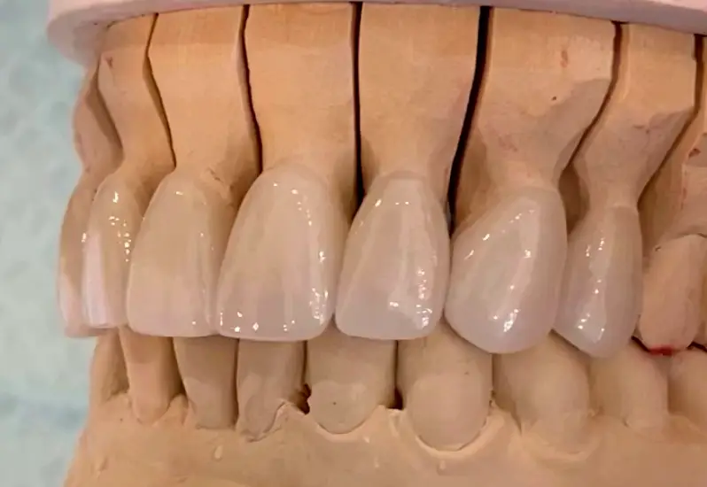 Manteca Nabeel Cajee, DDS, MICOI
