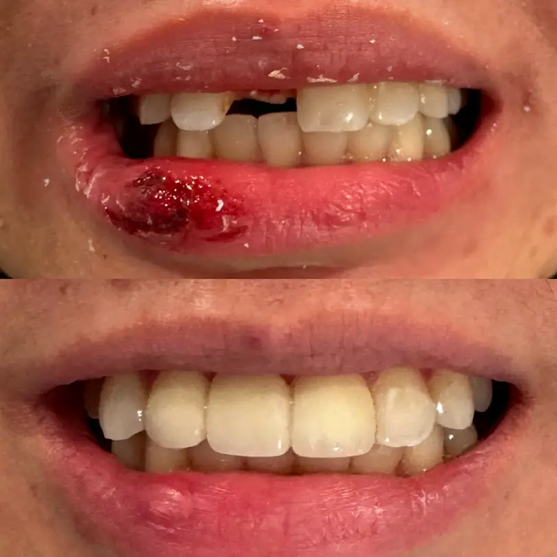 San Jose All Smiles Family Dentistry & Emergency Services
