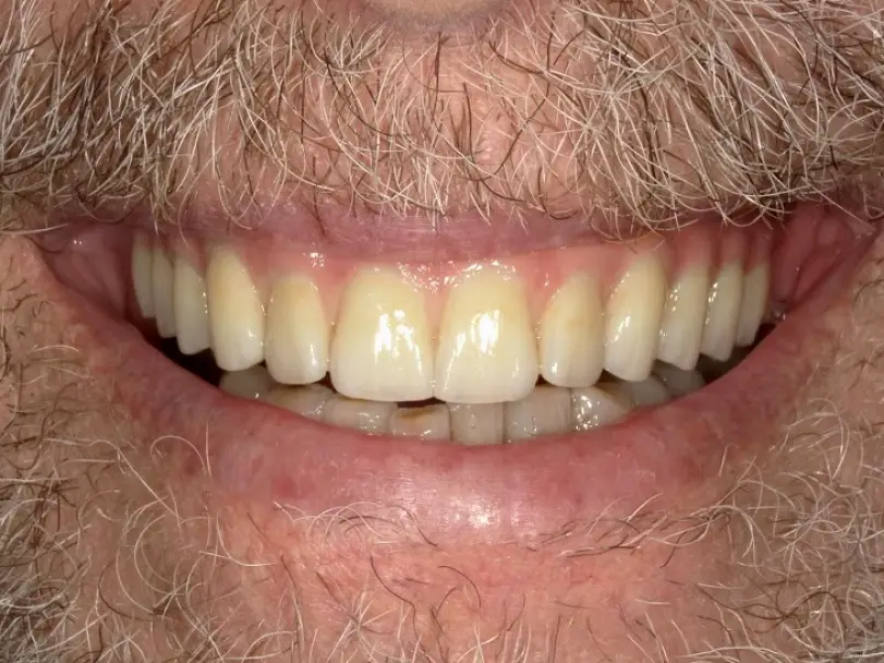 Sanford Shaun Janvier, D.M.D., Implant Cosmetic & Family Dentistry