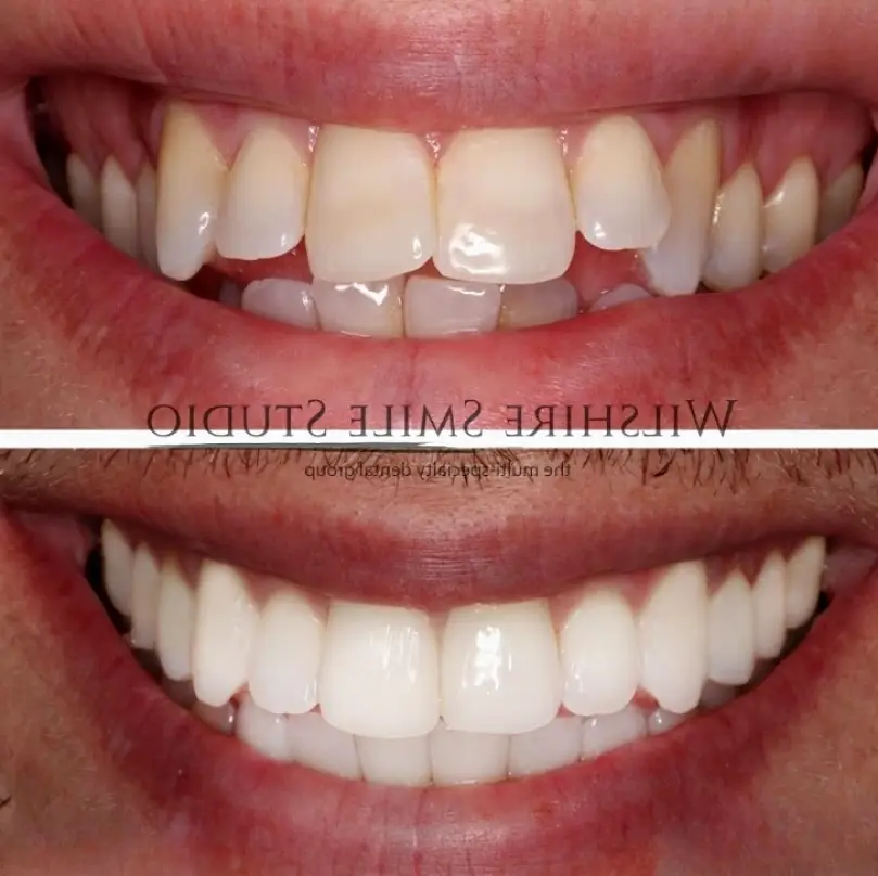  Wilshire Smile Studio - Los Angeles Dentist, Cosmetic and Emergency Dentistry