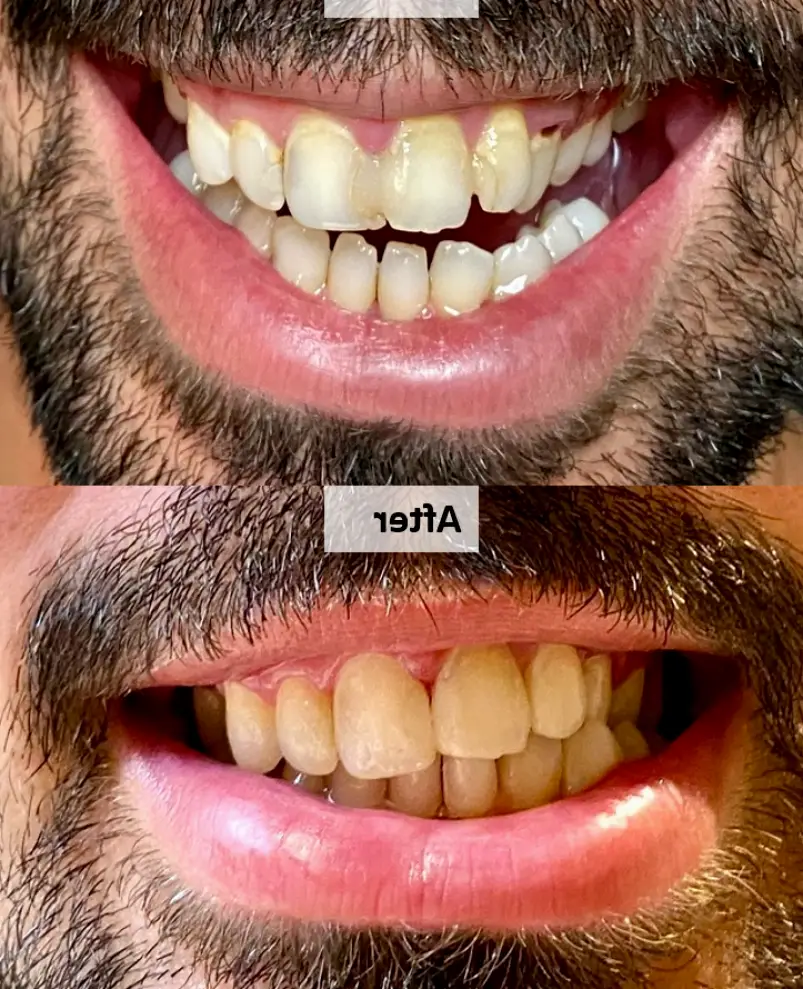Carson Heart Dental
