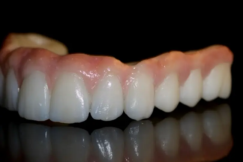 Eagle Mountain Design Dental Lab Arts