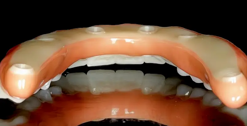 Kinston Affordable Dentures & Implants