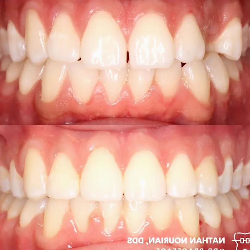 Panorama City Textbook Orthodontics