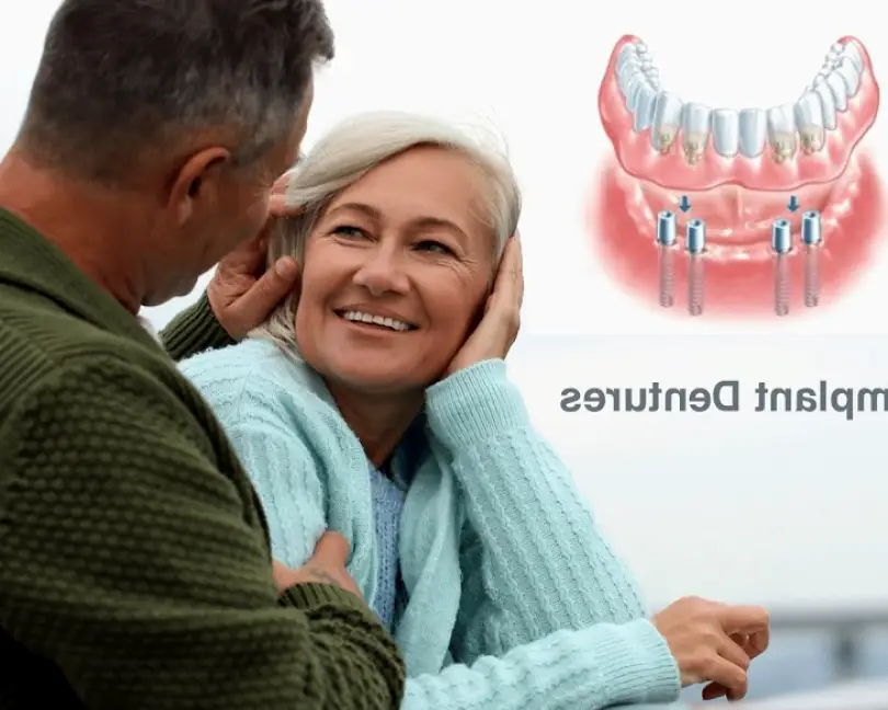 Vancouver Affordable Implant Dentures