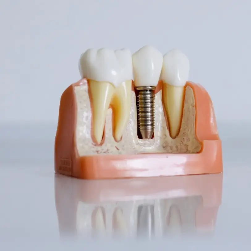 Parkersburg Richard Newhart, DDS