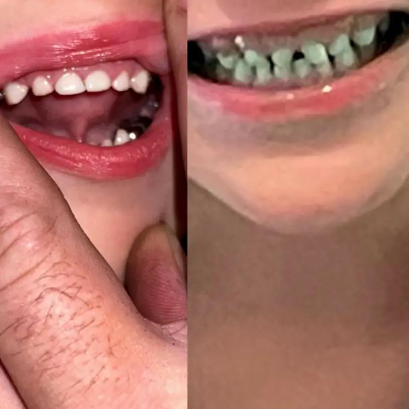 Baton Rouge Smile Stars Pediatric Dentistry and Orthodontics