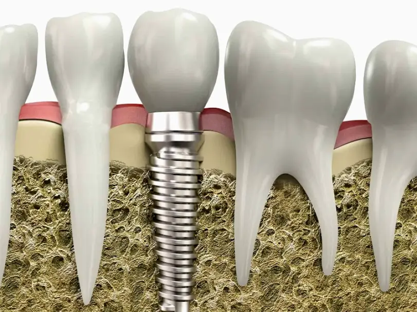 Pittsburg Loveridge Dental Group
