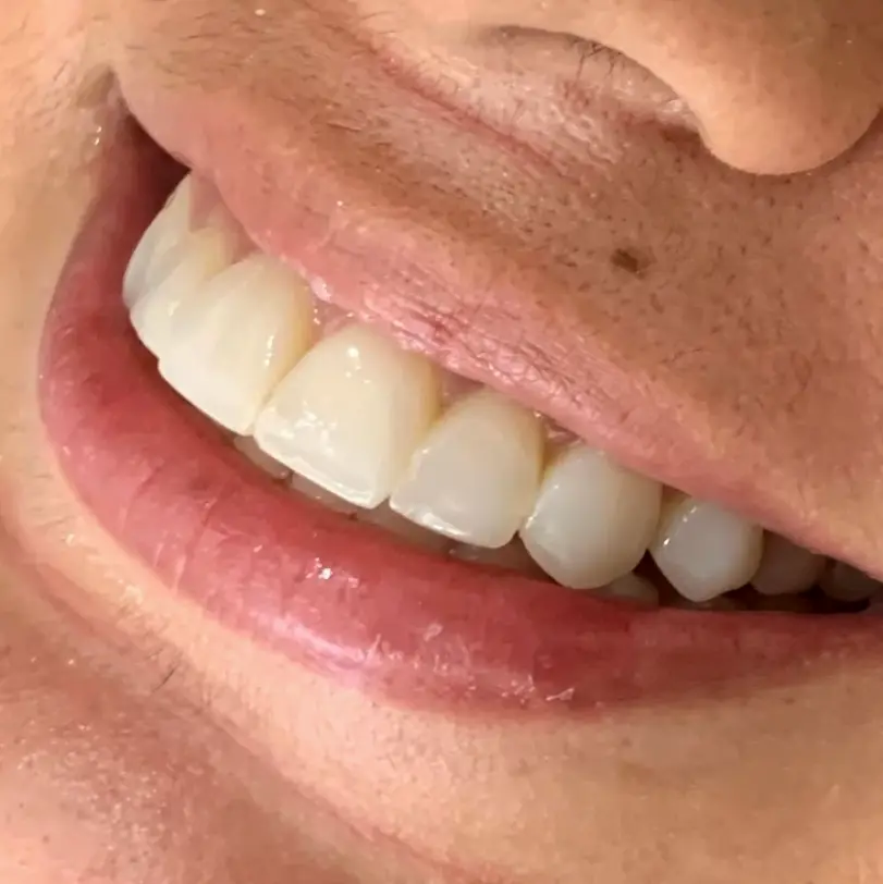  Flushing Smile Design NY