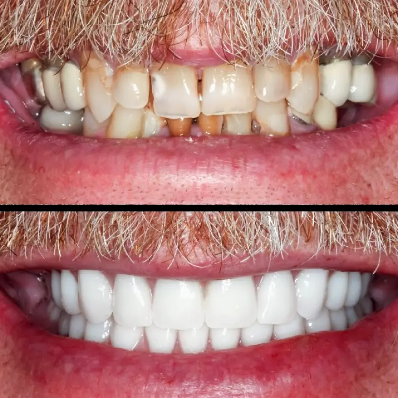 Flawless Smile Dentistry - Claremore