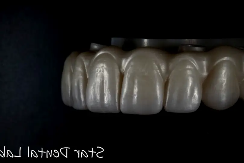 Bristol Star Dental Lab