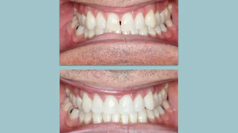 Vancouver Carter Park Dental