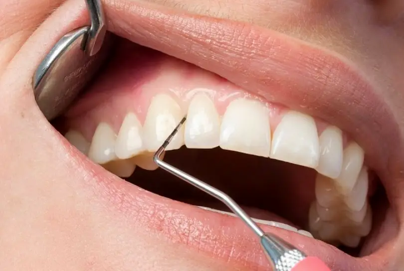 Ukiah Dental | Dr. Richard S. Phillips DDS