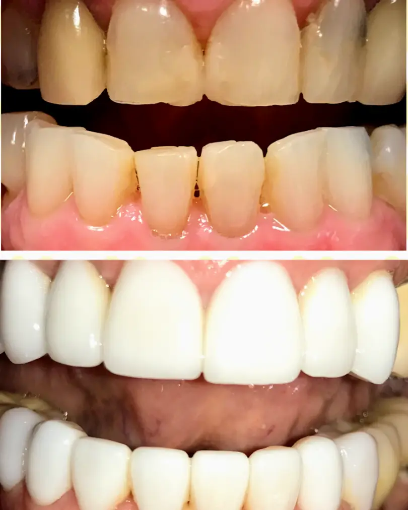Westmont Downers Dental