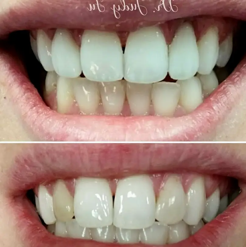 Battle Ground Daybreak Dental