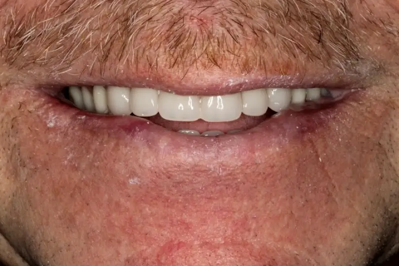 Spearfish Dana Dental Arts