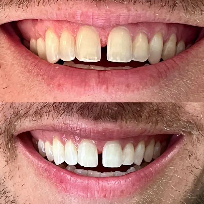 Holistic Smiles LA: Jason N Monempour, DDS - Santa Monica
