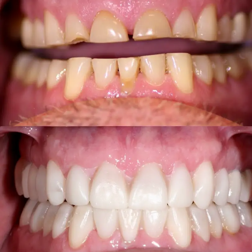 Illume Dental of McKinney