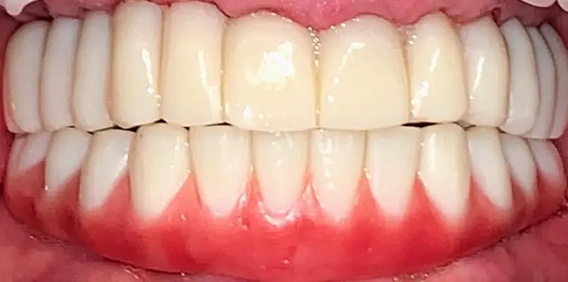 Searcy Dental Implant Docs