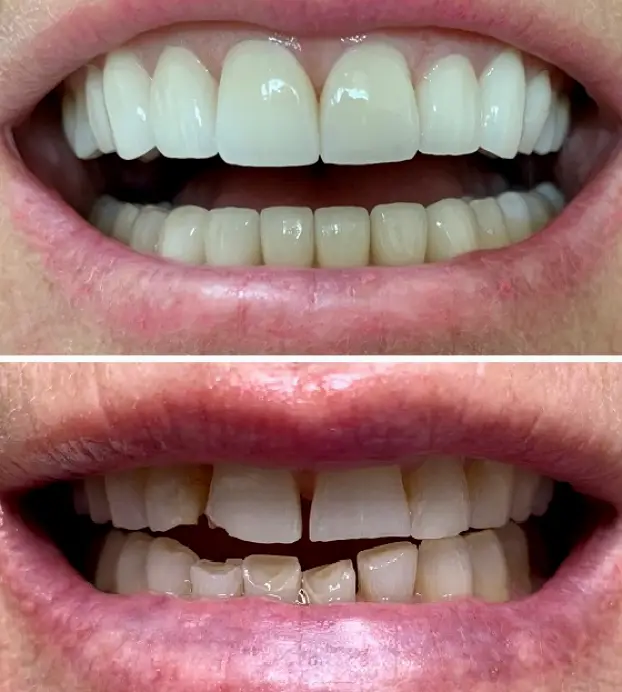 Northridge Sterling Smile Dental Care