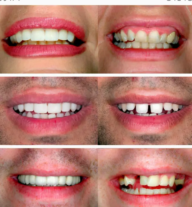 Patchogue Dental Services