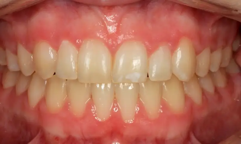 Pioneer Elevation Dental