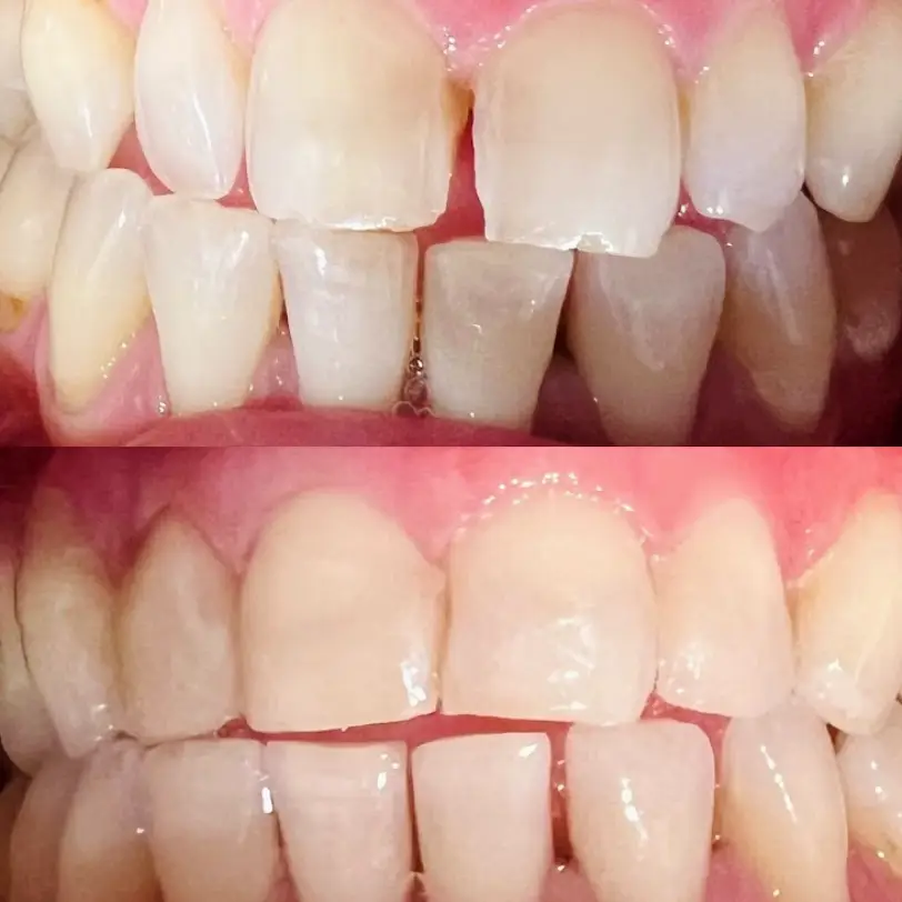 The Colony Care Dental