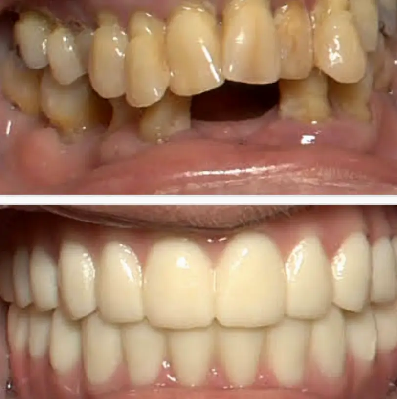 Dental Implants of Spring Hill