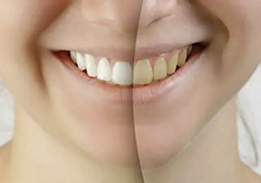  Saratoga Springs Saratoga Family Dentistry
