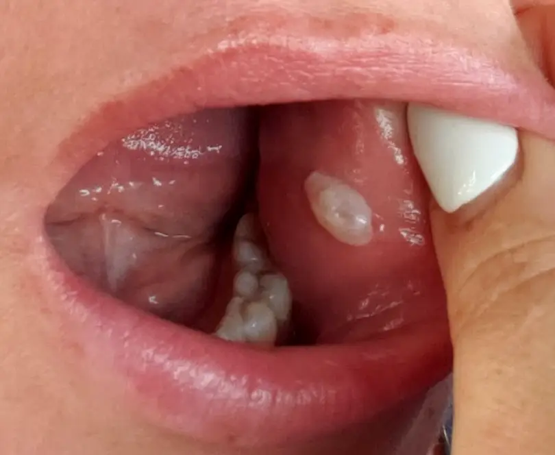 Myrtle Beach Inlet Premier Implant & Cosmetic Dentistry