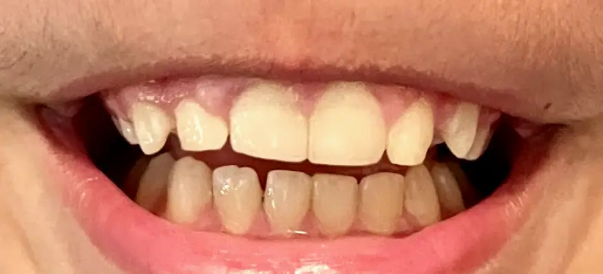 Ramona Grant Liske, DDS