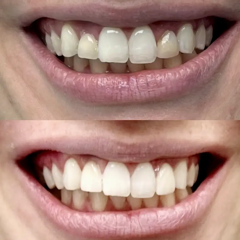 Valhalla Dental PLLC