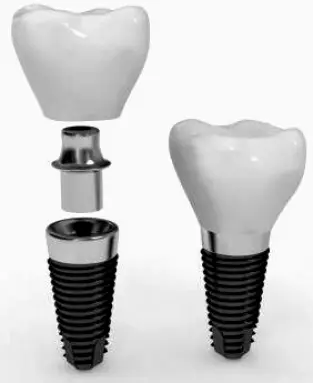Tustin ICONIC Periodontics and Dental Implants