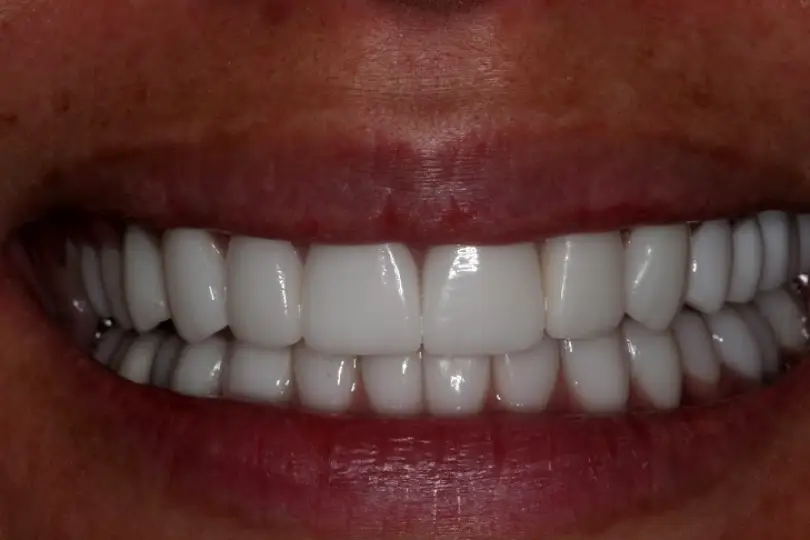 Pinellas Park Dr. Eric D. Arias, DDS