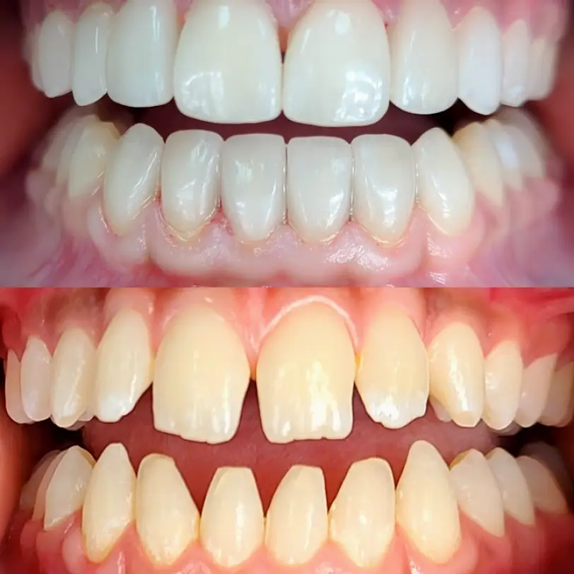 Main Street Implant & Family Dentistry, El Dorado, KS Dentist