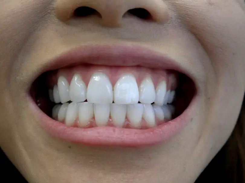 Santa Monica Pacific View Smile Center