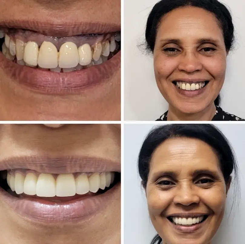 Towson Love Your New Smile-Dr Peter Diacoloukas