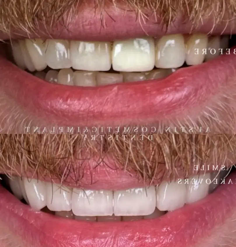  Austin Cosmetic & Implant Dentistry