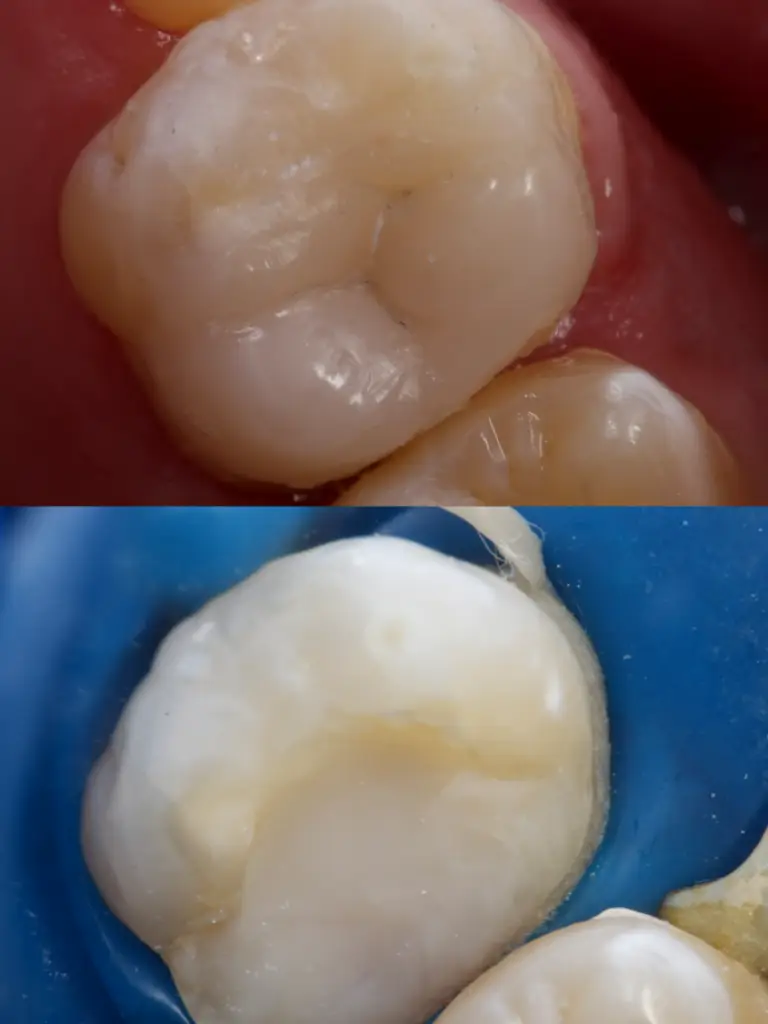 Tijuana Dentista Yessica Ornelas
