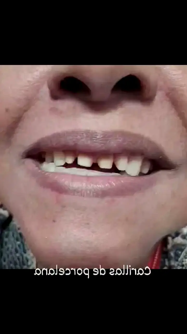 Cabo San Lucas Gs Dental odontología integral