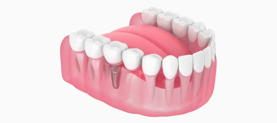 Clifton Dr. Anna Gazu, DMD; Marvel Dental Practice