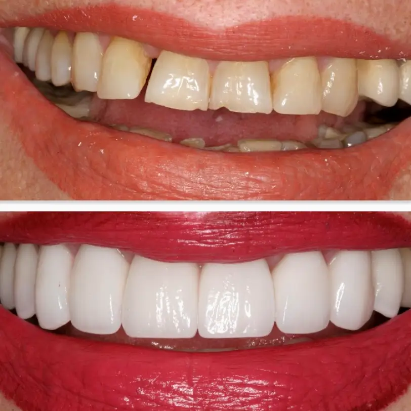 Cupertino Dr. J.J. Salehieh, DDS