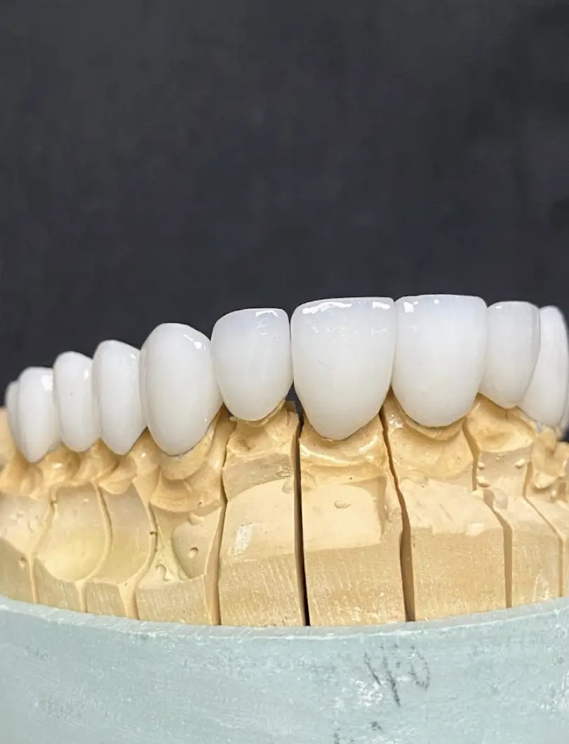 Kennestone Dentist (Formerly Polish Dental Center Marietta)