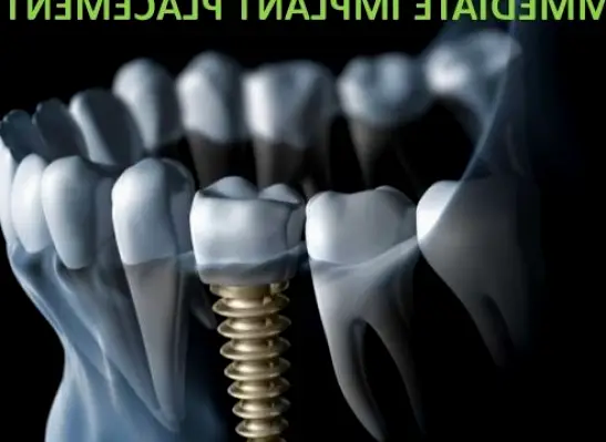 West Simsbury Advanced Valley Dental