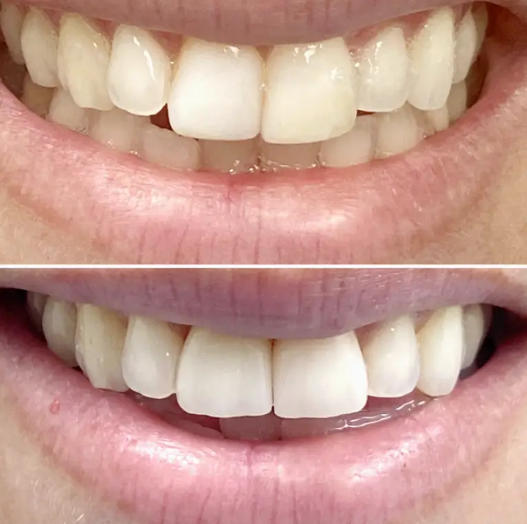 Boynton Beach Sunshine State Dentistry