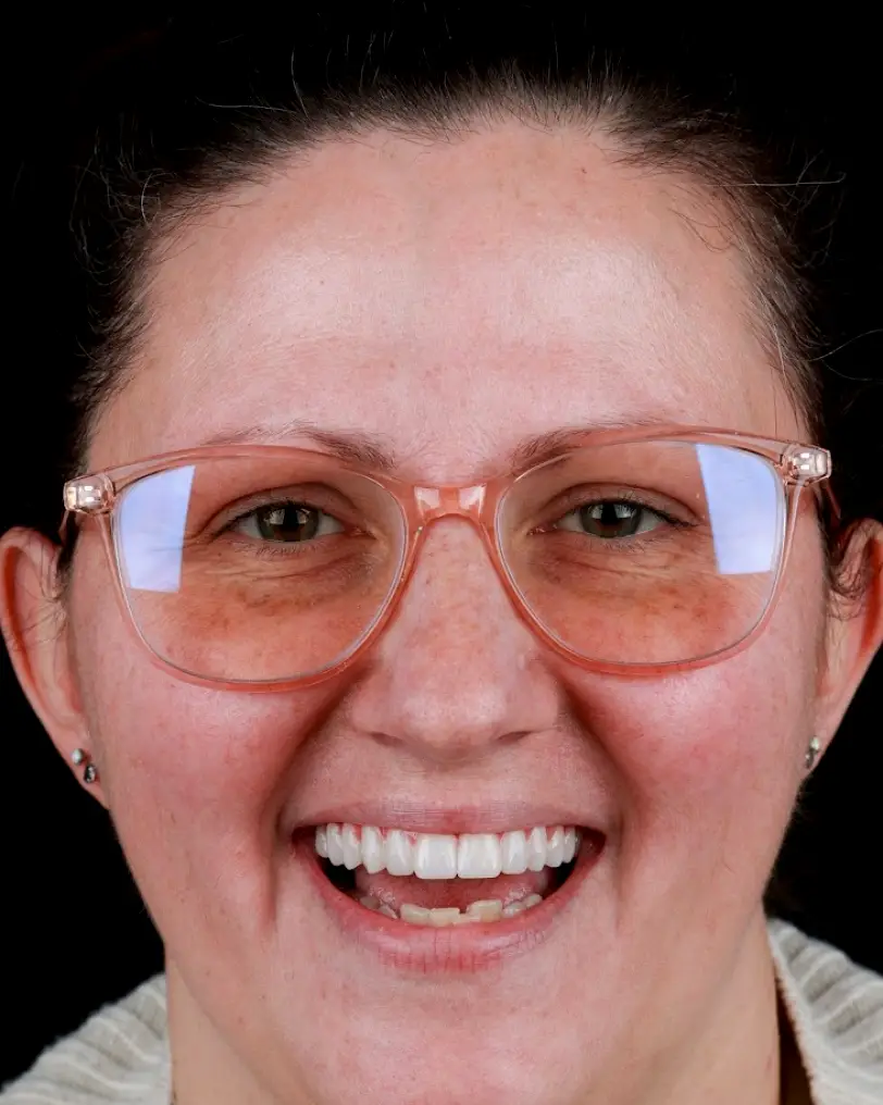 Hamden Signature Smiles Dental Implants and Cosmetic Dentistry