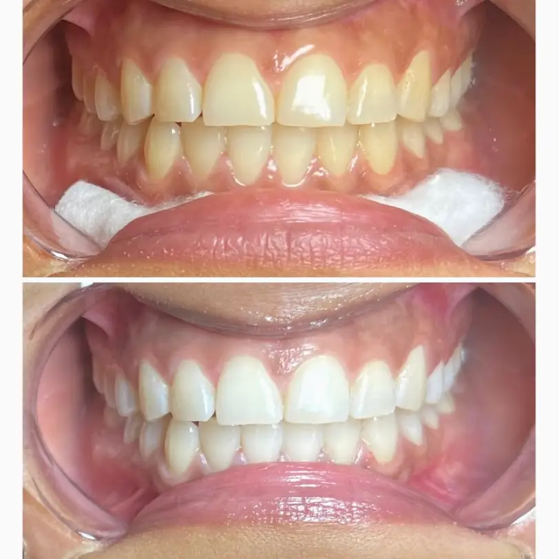 Jacksonville Diamond Smiles