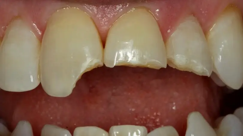 Longboat Key Dental - Dr. Michael J. O'Neil DDS