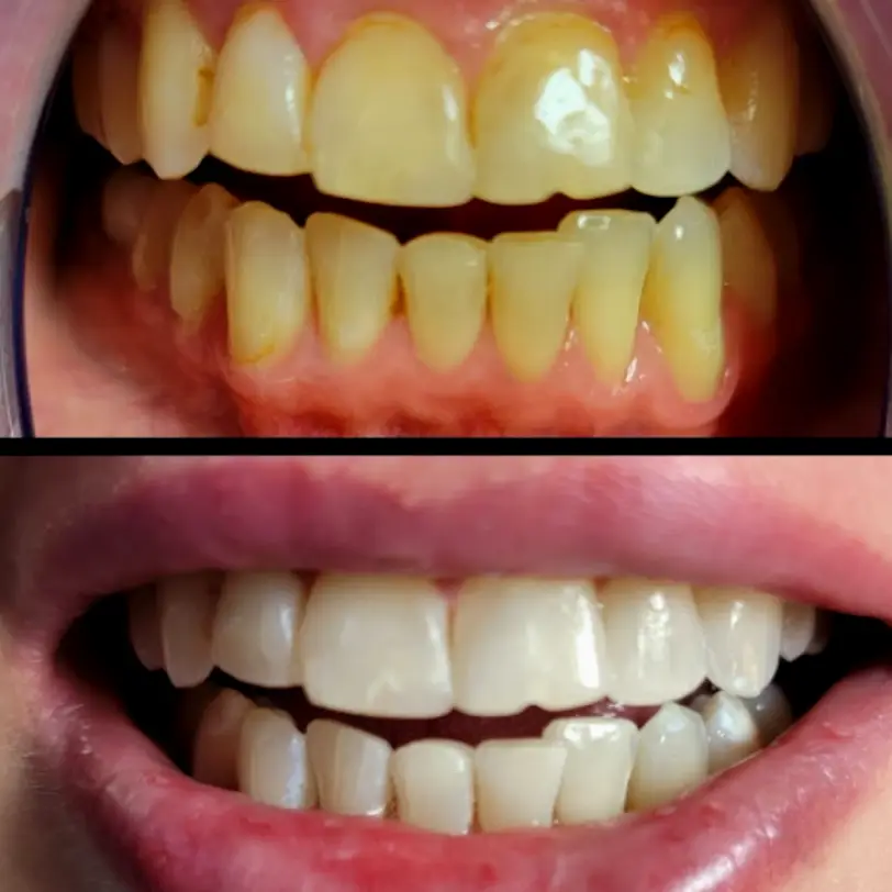 Portland Smile Labs PDX
